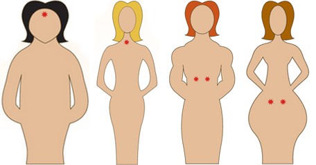 Profils des 4 types glandulaires